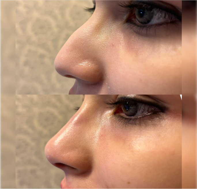 FOTOS RESULTADOS 001