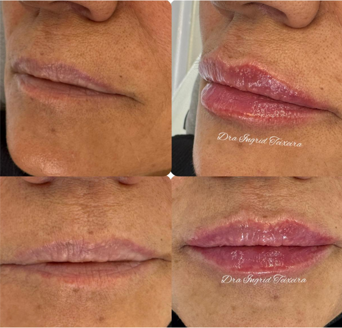 FOTOS RESULTADOS 002