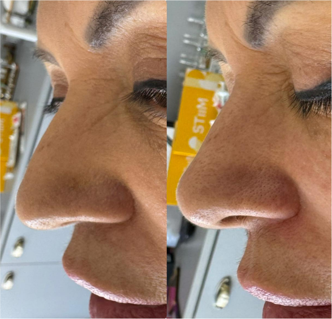 FOTOS RESULTADOS 003