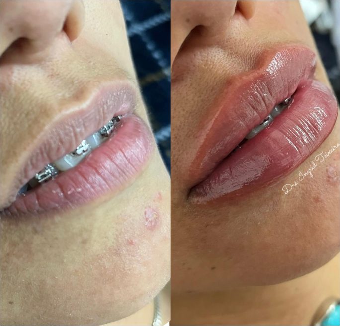 FOTOS RESULTADOS 004