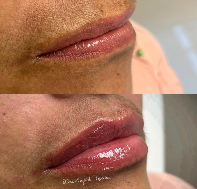 FOTOS RESULTADOS 006