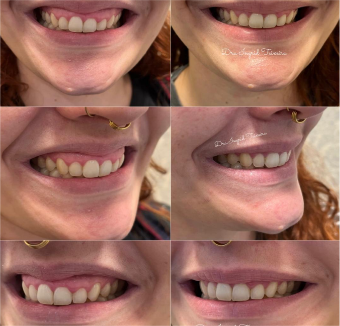 FOTOS RESULTADOS 007