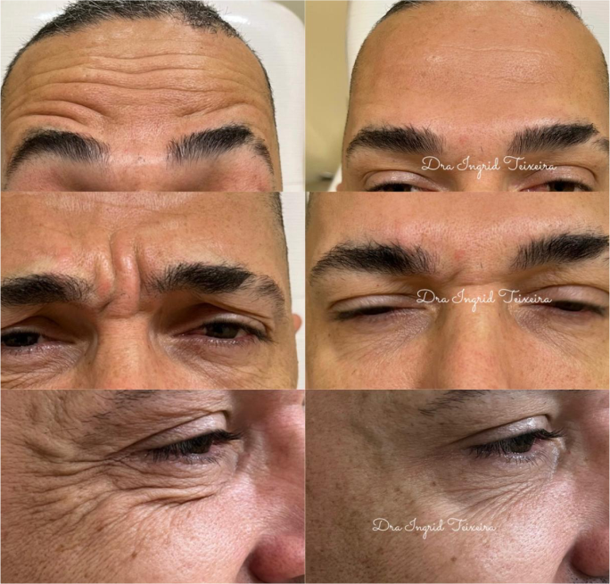 FOTOS RESULTADOS 008