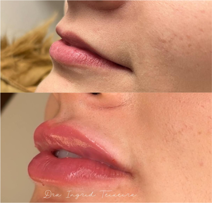 FOTOS RESULTADOS 009