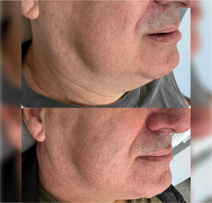 FOTOS RESULTADOS 010