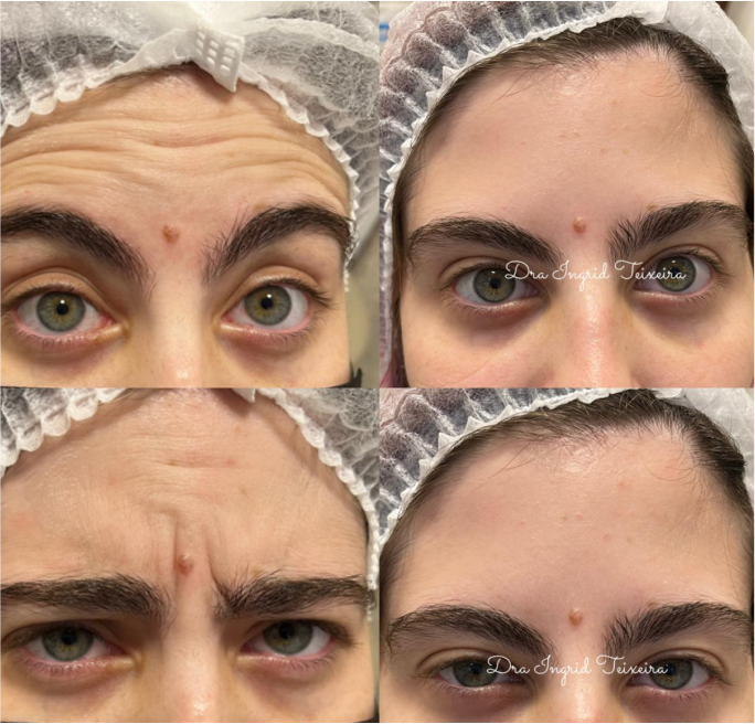 FOTOS RESULTADOS 011