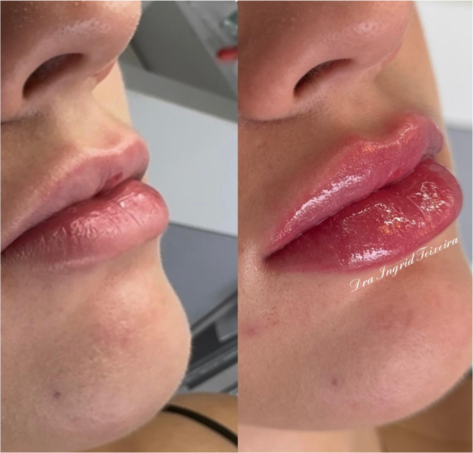 FOTOS RESULTADOS 012