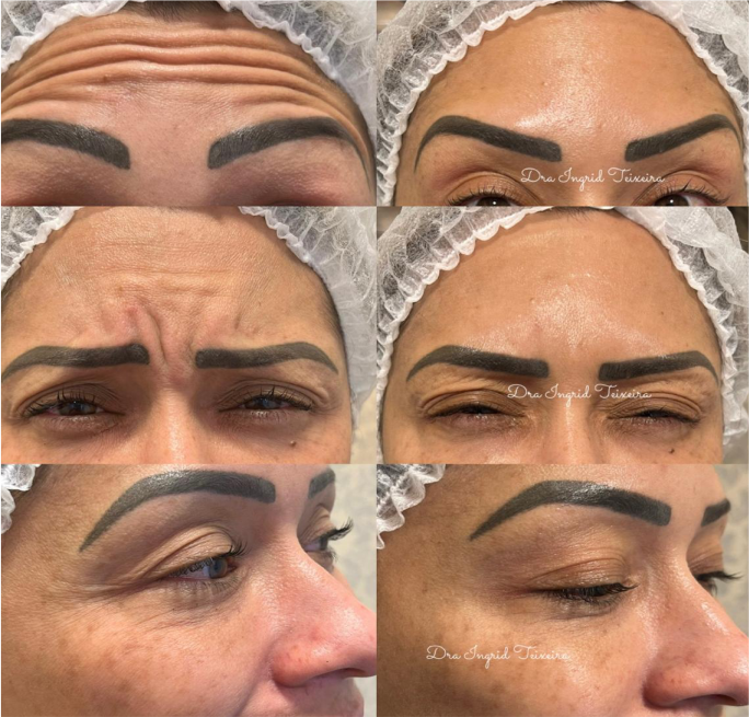 FOTOS RESULTADOS 013