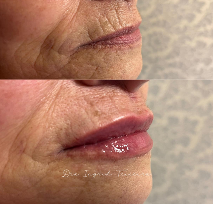 FOTOS RESULTADOS 014