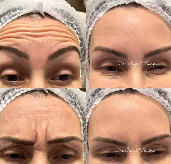 FOTOS RESULTADOS 015