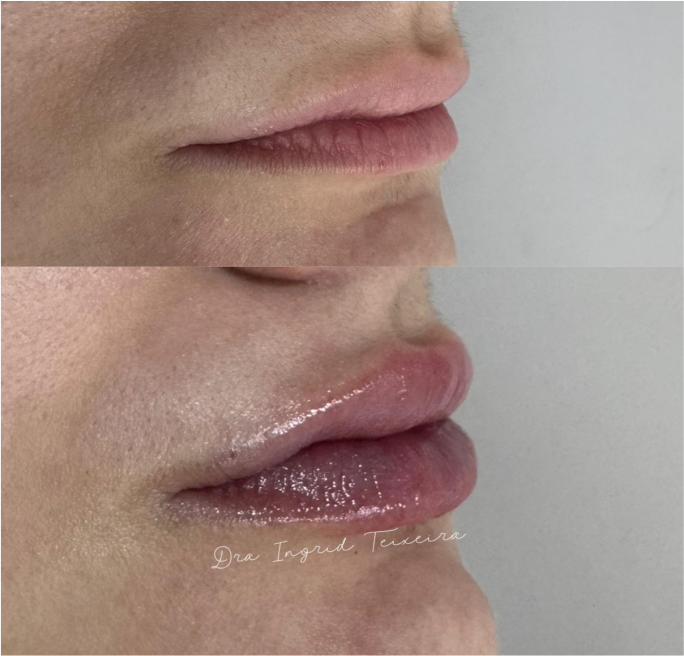 FOTOS RESULTADOS 017