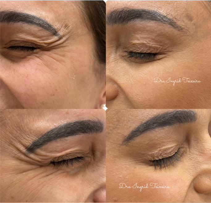 FOTOS RESULTADOS 018