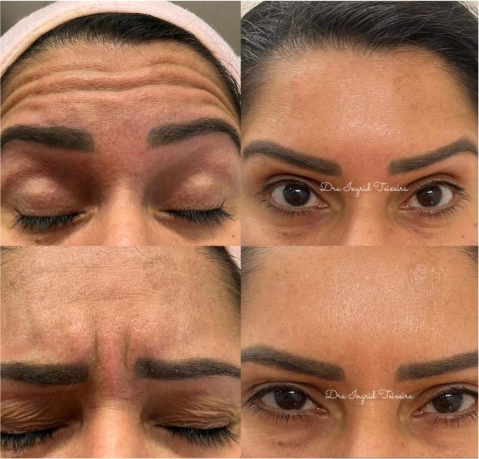 FOTOS RESULTADOS 019