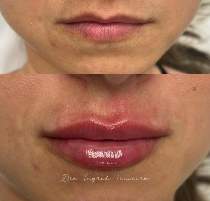 FOTOS RESULTADOS 020