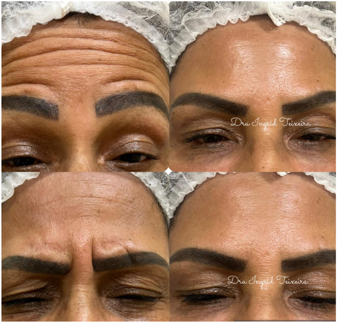 FOTOS RESULTADOS 021