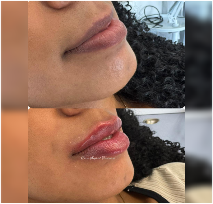 FOTOS RESULTADOS 022