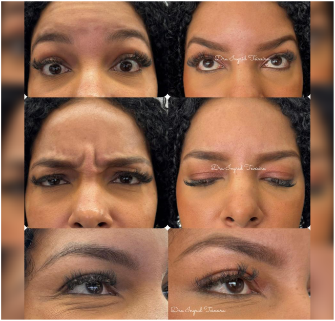 FOTOS RESULTADOS 023