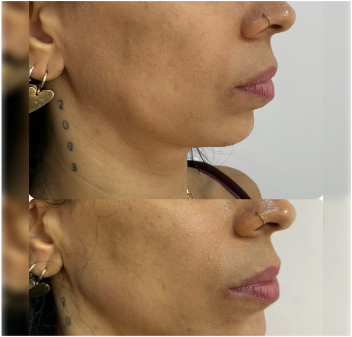 FOTOS RESULTADOS 025