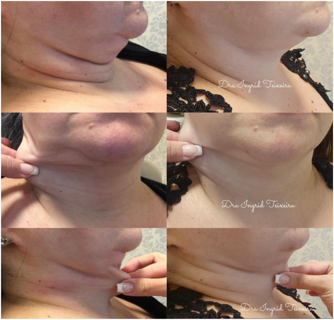 FOTOS RESULTADOS 026