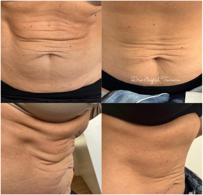 FOTOS RESULTADOS 027