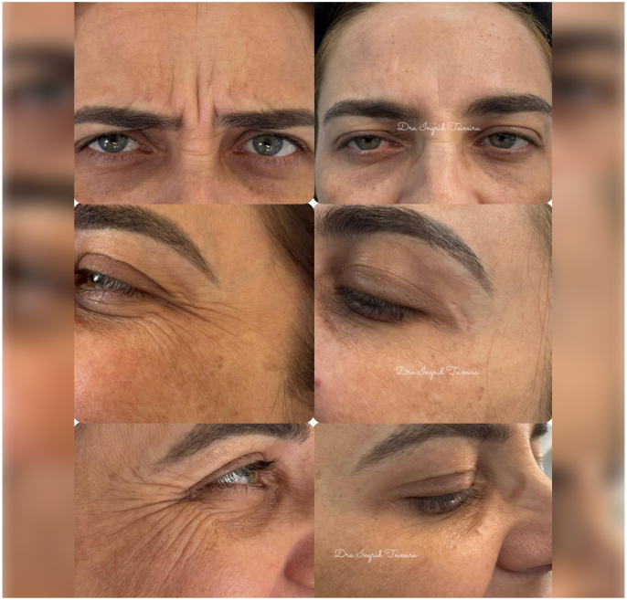 FOTOS RESULTADOS 028