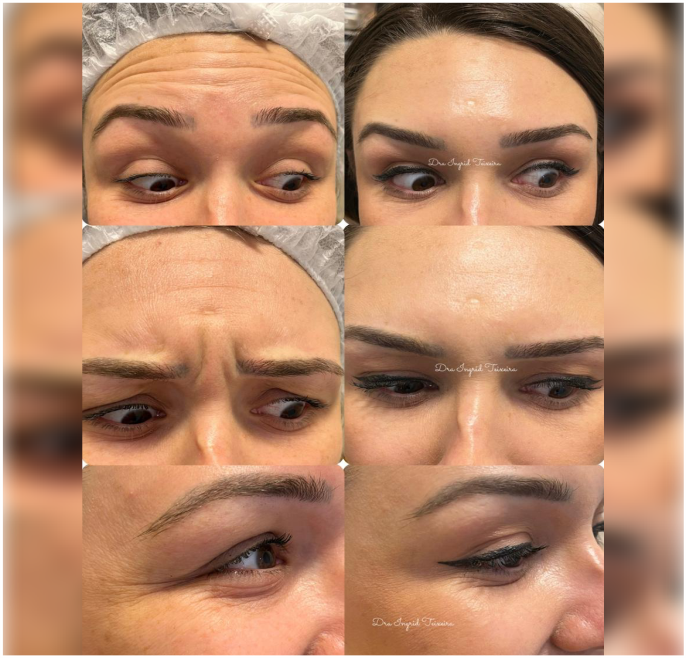 FOTOS RESULTADOS 029