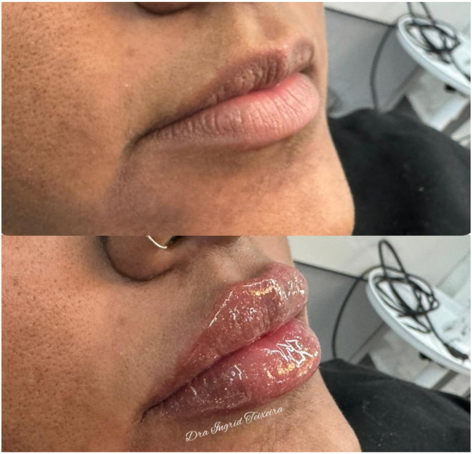 FOTOS RESULTADOS 030