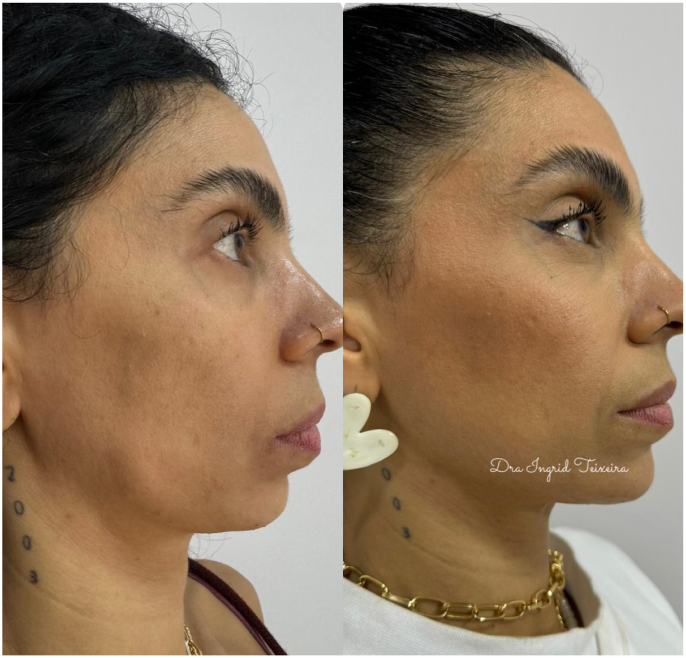 FOTOS RESULTADOS 031