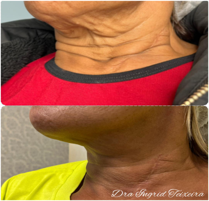 FOTOS RESULTADOS 032