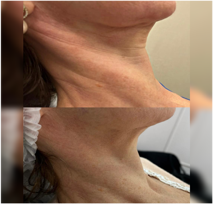 FOTOS RESULTADOS 033