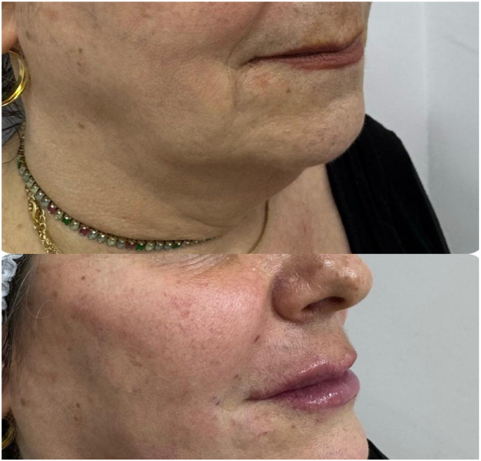 FOTOS RESULTADOS 035