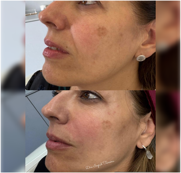 FOTOS RESULTADOS 036