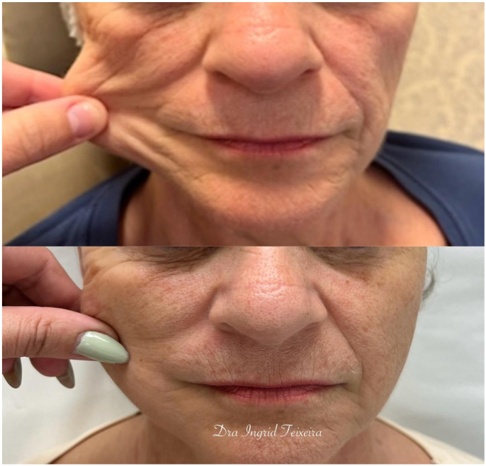 FOTOS RESULTADOS 037