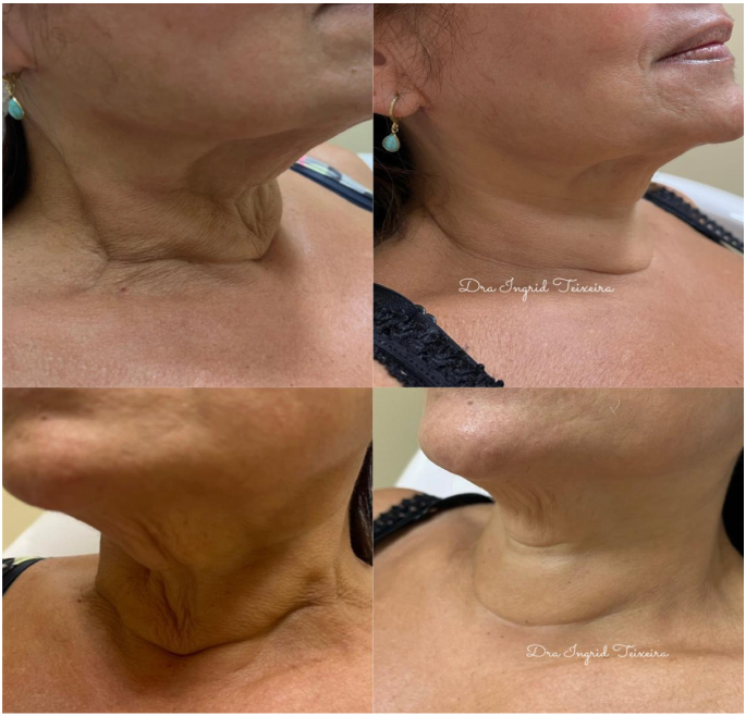 FOTOS RESULTADOS 038