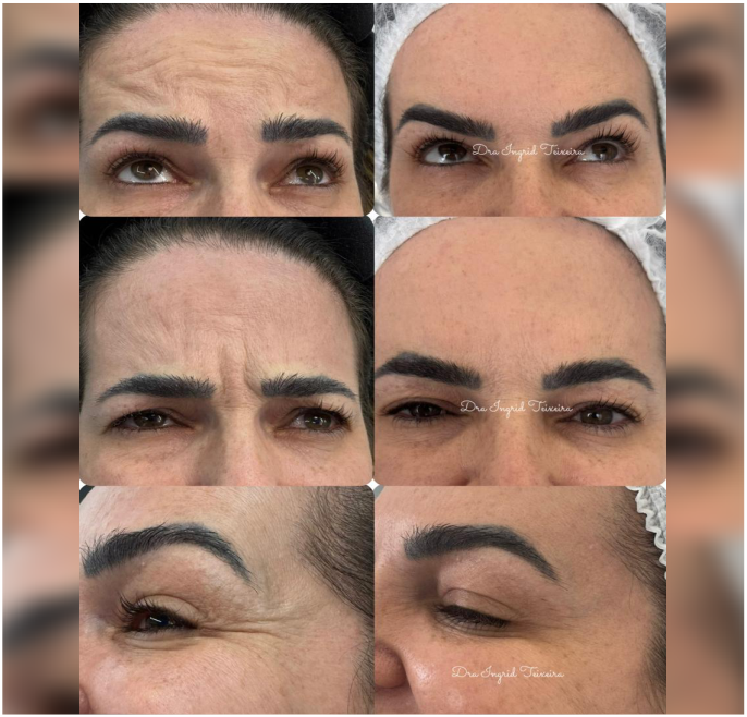 FOTOS RESULTADOS 039