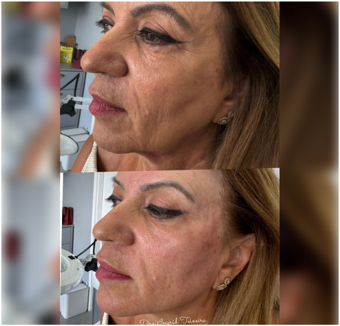 FOTOS RESULTADOS 040